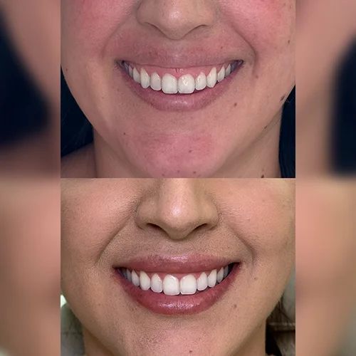 labios1