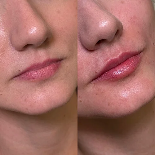 labios10