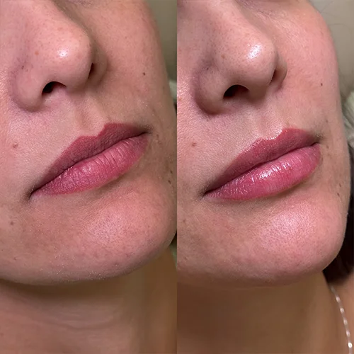 labios11