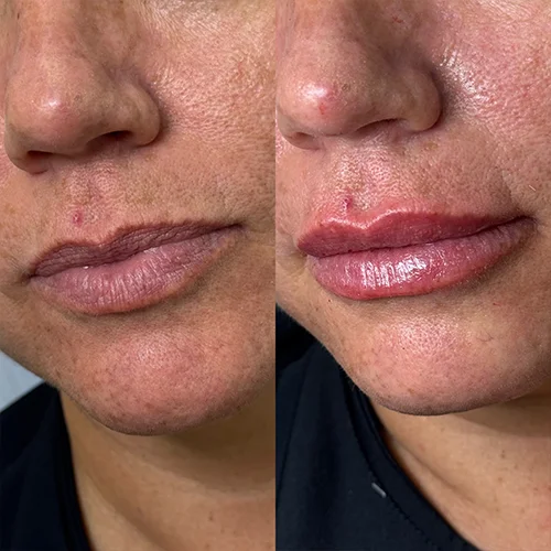 labios3