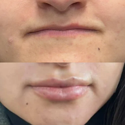 labios4