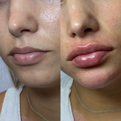 labios5