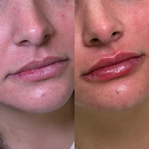 labios6
