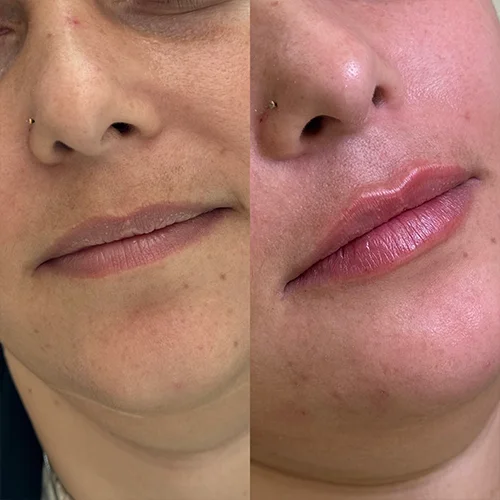 labios7