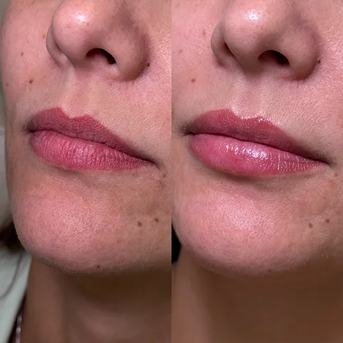 labios8
