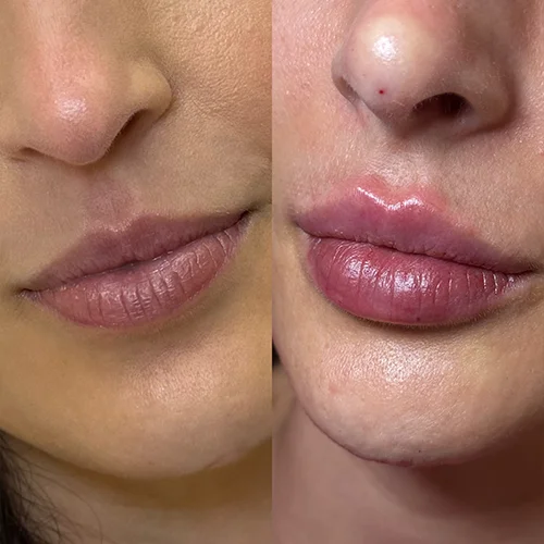 labios9