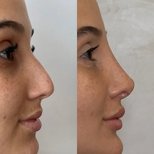 rino6